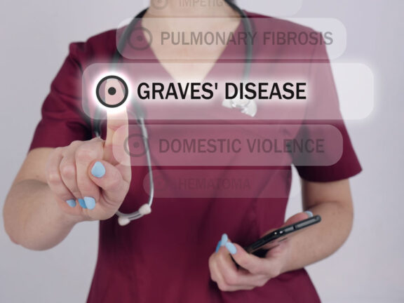 Graves' Disease graphic
